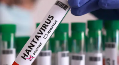 Gli scienziati hanno scoperto che l'hantavirus può persistere nello sperma degli uomini per sei anni dopo l'infezione