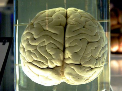 Scienziato scopre regione nascosta del cervello umano