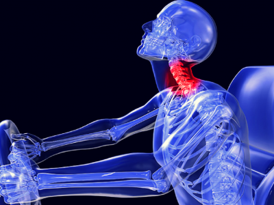 Altro “Stop” della Cassazione alle assicurazioni: risarcibili anche le lesioni non “strumentalmente accertate” come con le radiografie. 