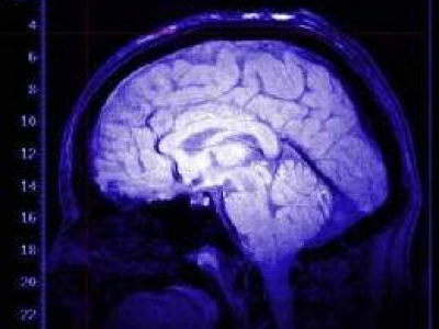Canada: uno scienziato di alto livello afferma che gli è stato vietato di studiare una misteriosa malattia cerebrale